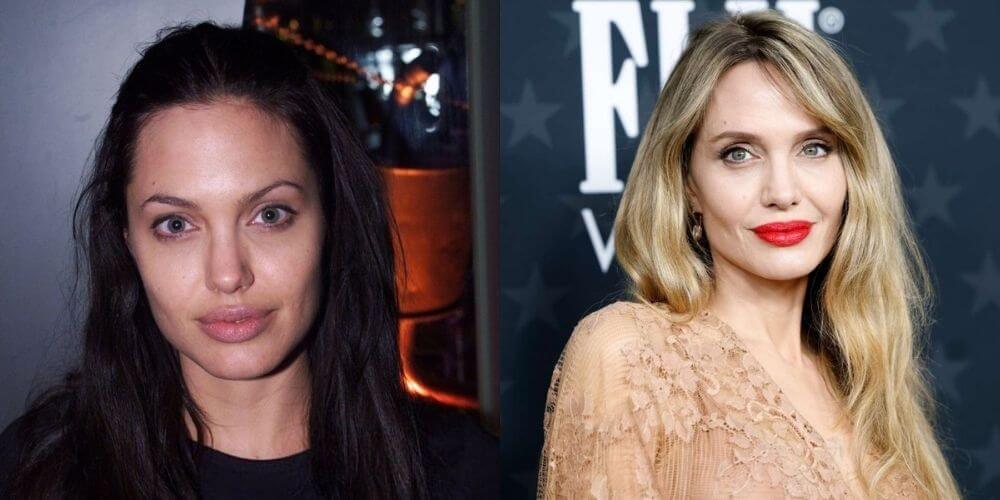 Angelina Jolie Before and After Surgery