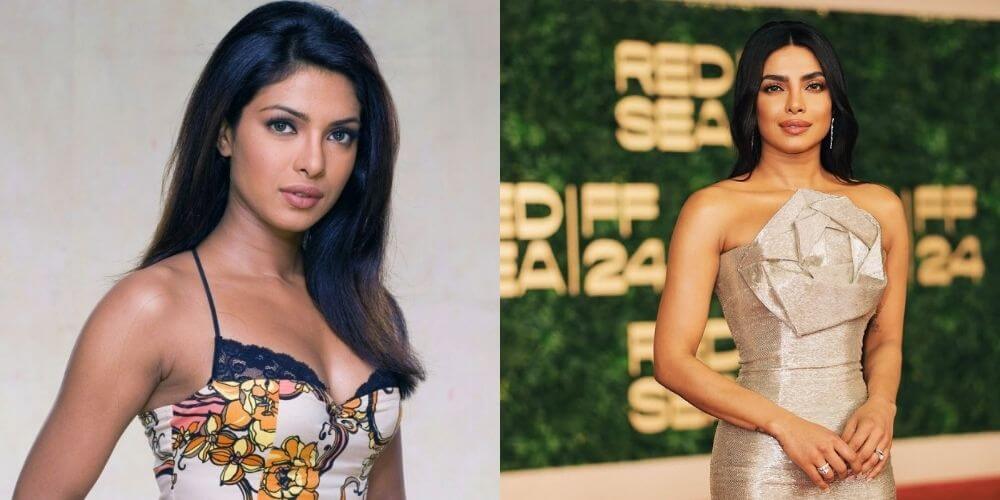 Priyanka Chopra Before and After Surgery